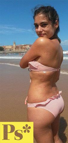 Nerea